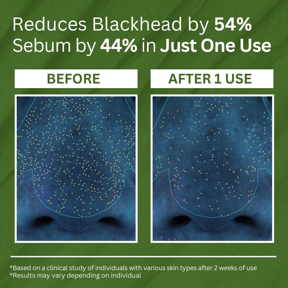 Deep Clean, Glowing Skin! π§ LOVILDS Bubble Deep Mask β Limited Time Offer, Grab Yours Now! β°