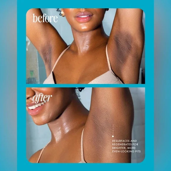 ⚡️Post-waxing rescue in 5 seconds: Bumps disappear, skin glows! Glass-Smooth Oil.